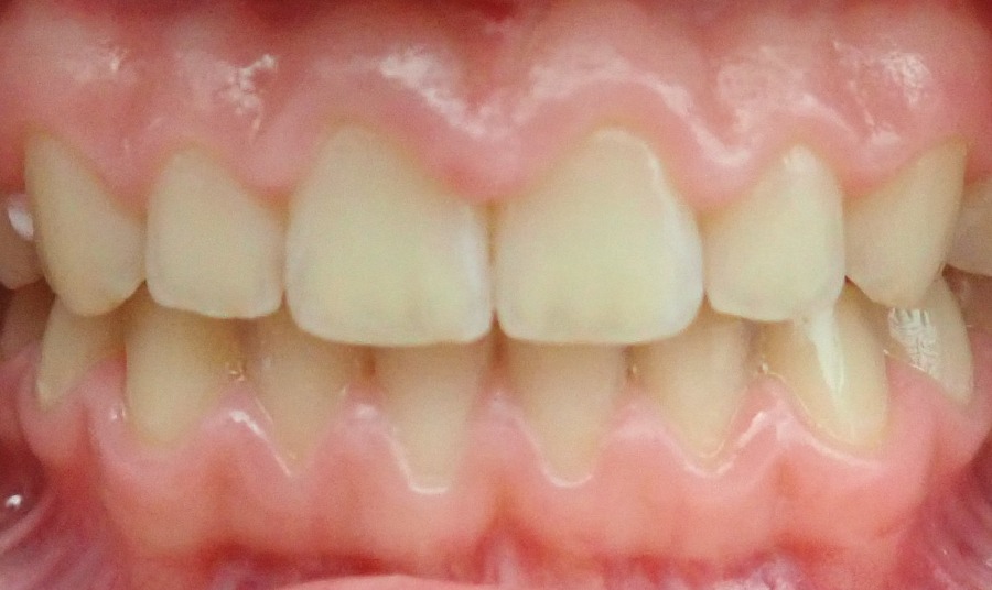 After Image