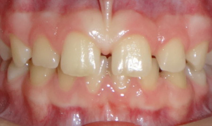Before Image