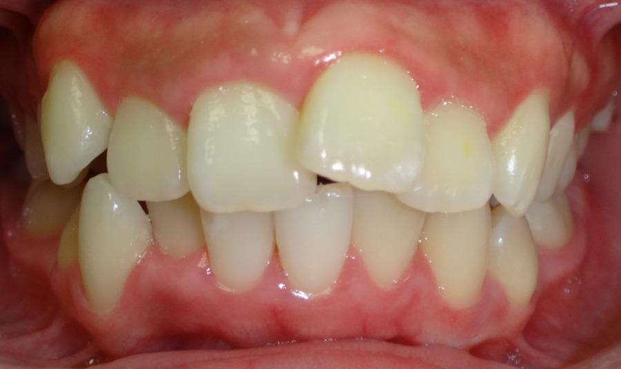 Before Image