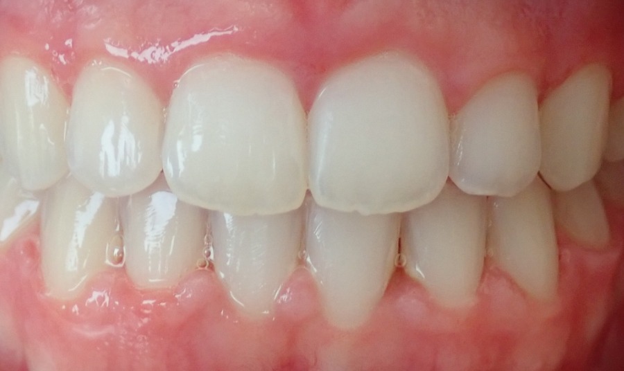 After Image