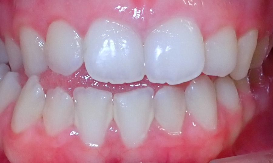 Before Image