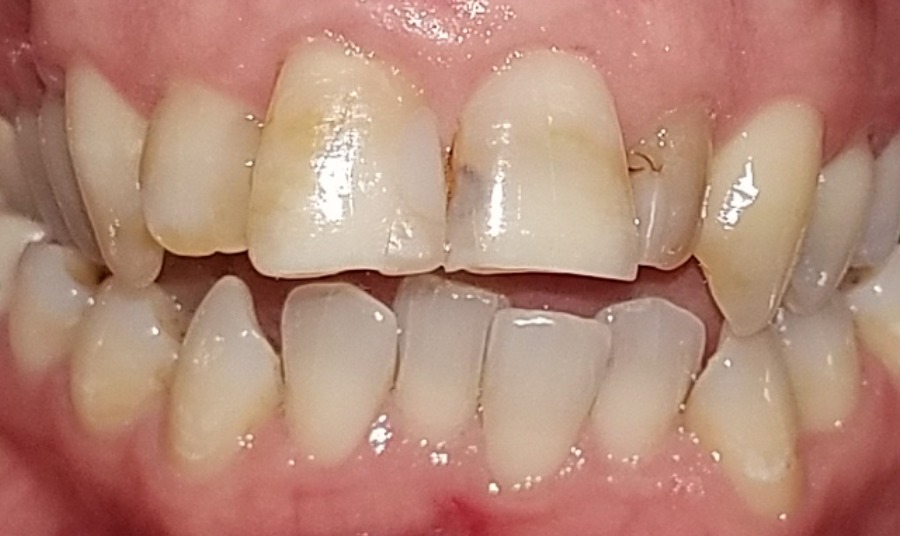 Before Image