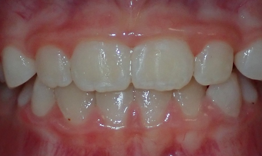After Image