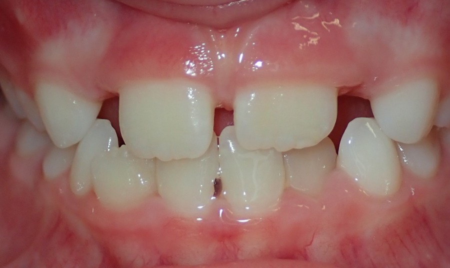 Before Image