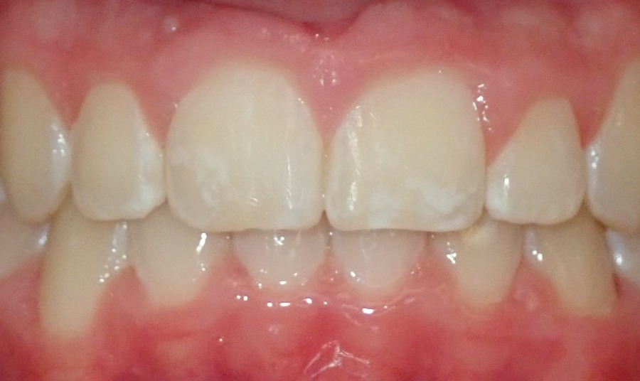 After Image