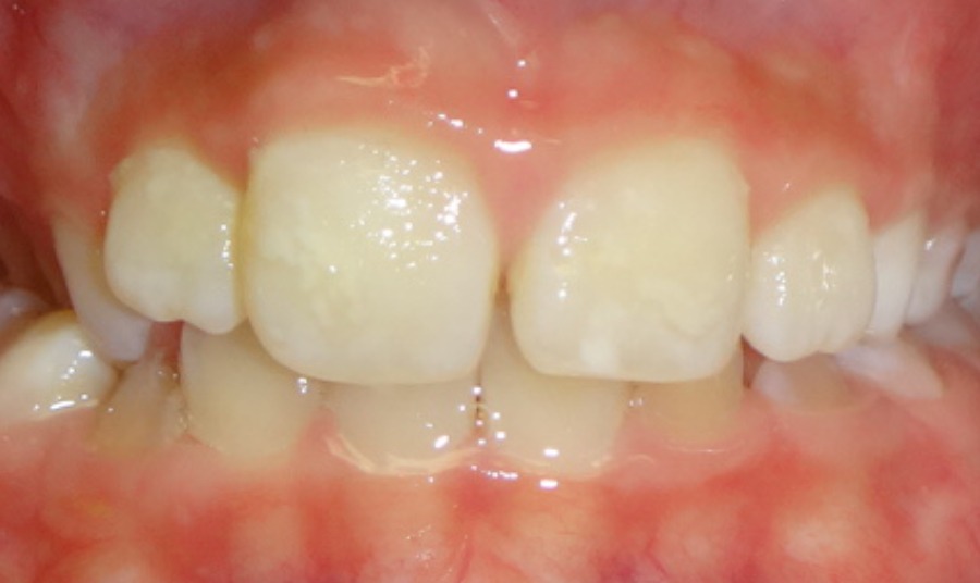 Before Image