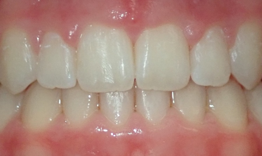 After Image