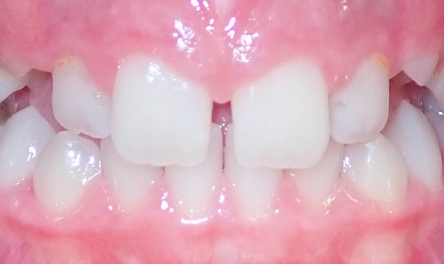 Before Image