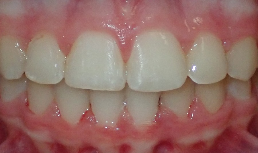 After Image