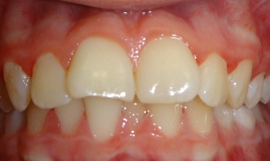 Before Image