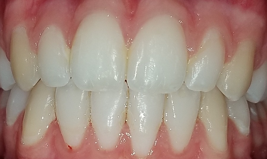After Image