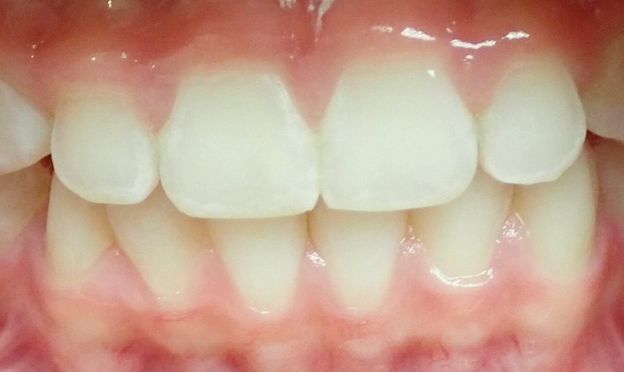 After Image