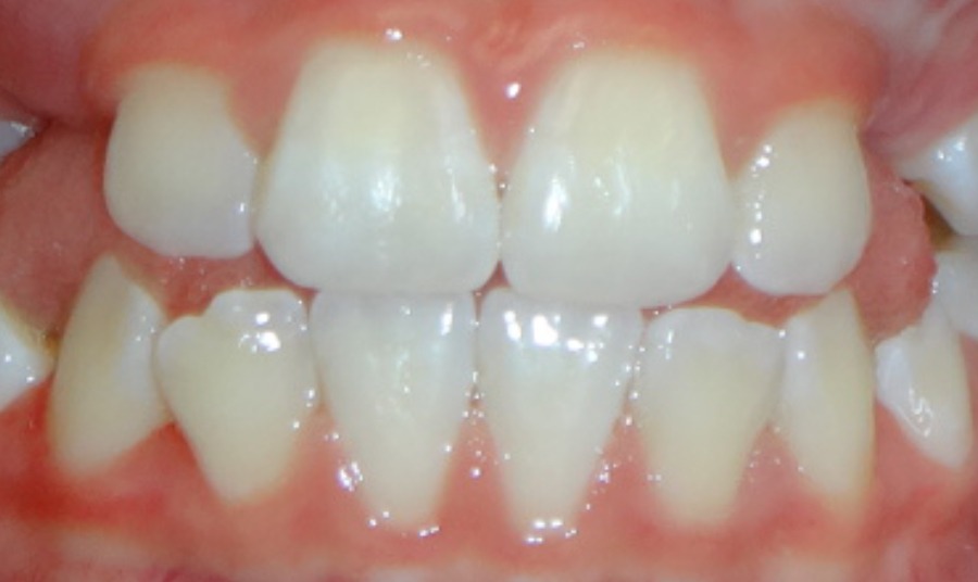 Before Image