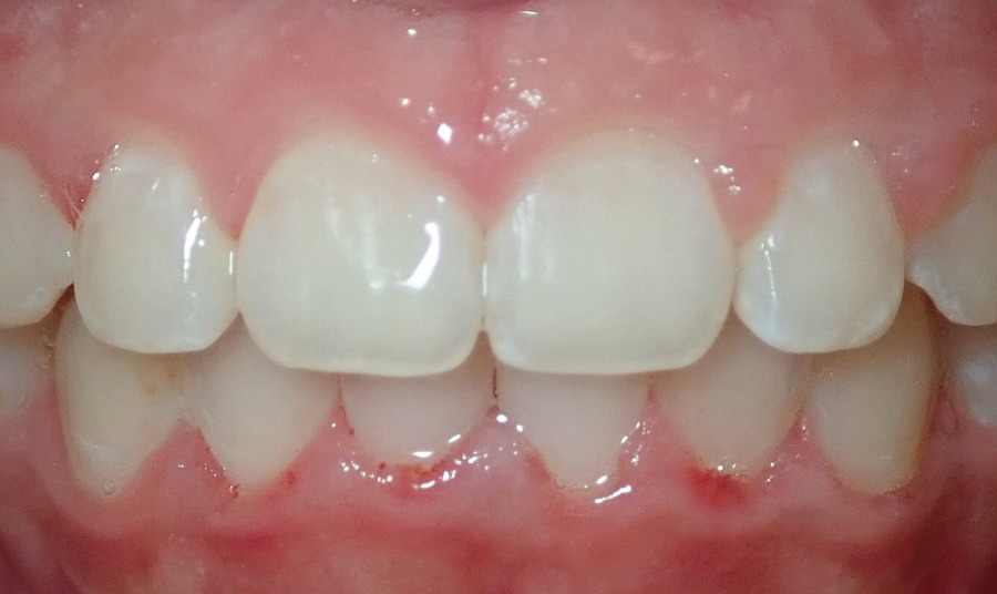 After Image