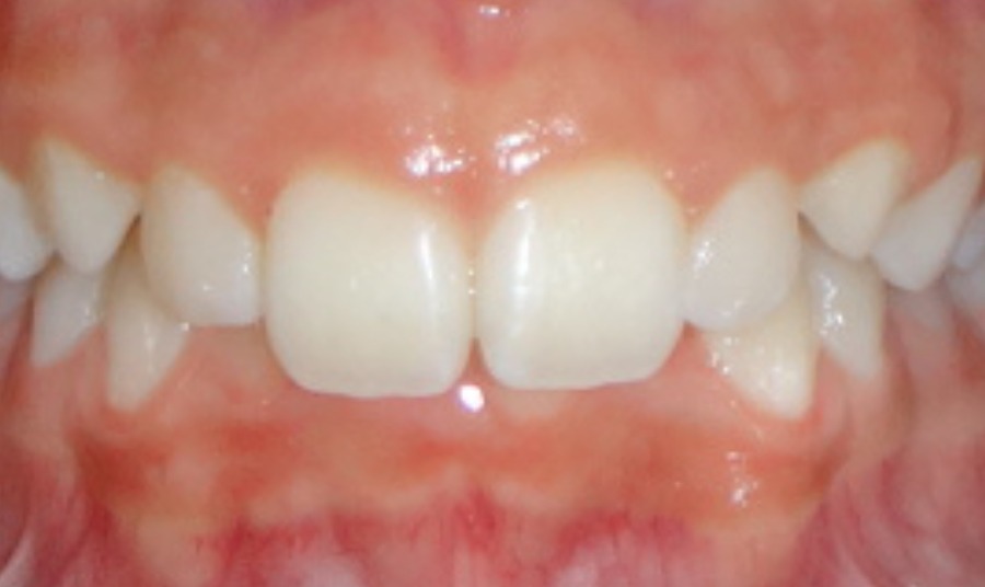 Before Image