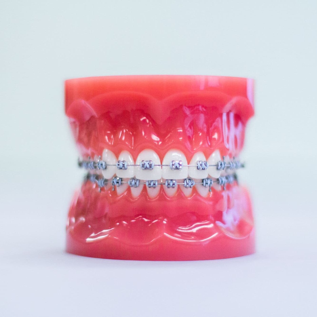Overland Park Braces