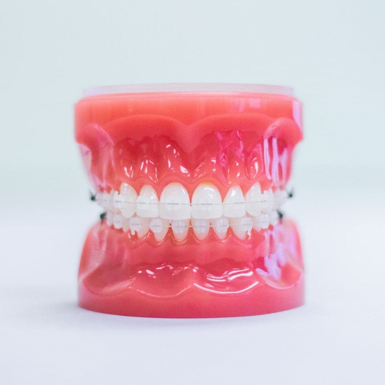 Olathe KS Invisalign