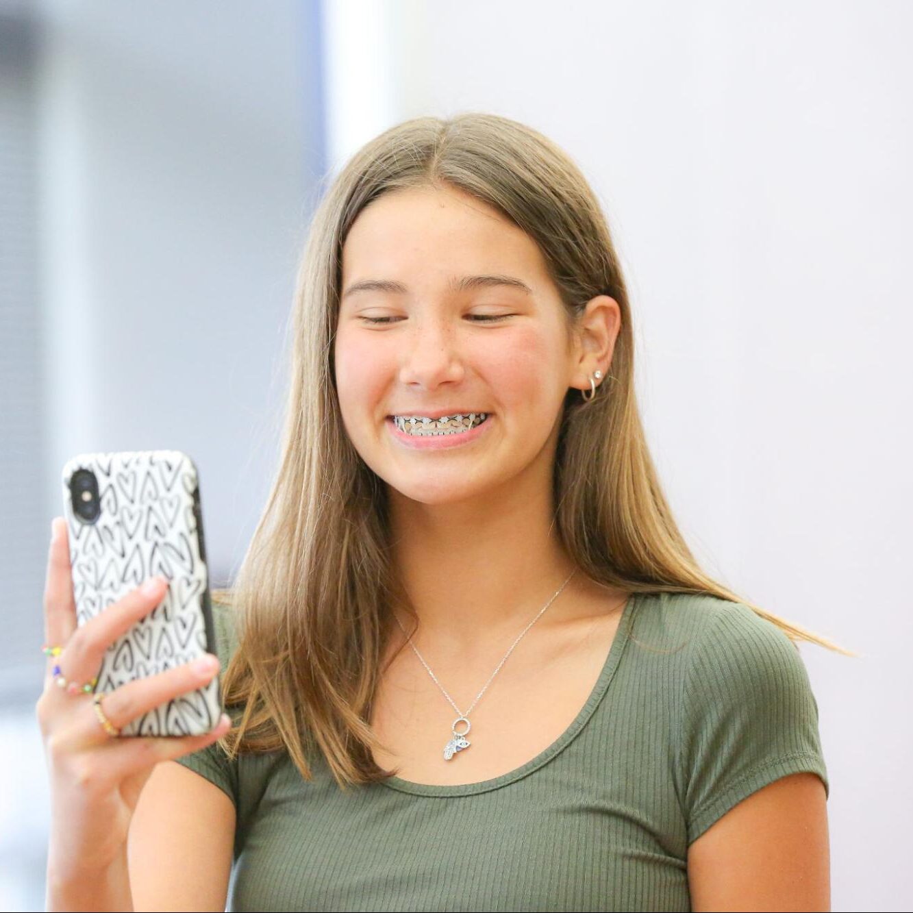 What Are Some Tips For Adjusting to Braces?